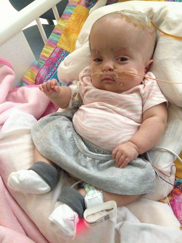 Because She Has Brain Cancer ! Nobody Cared to Pray for Kaity ! Can She Even Get Your 1 Like, Amen &amp; Share...