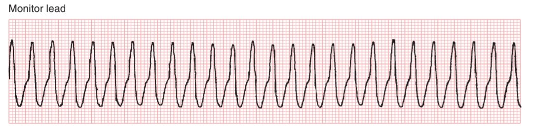 CardiovascularCorner tweet media