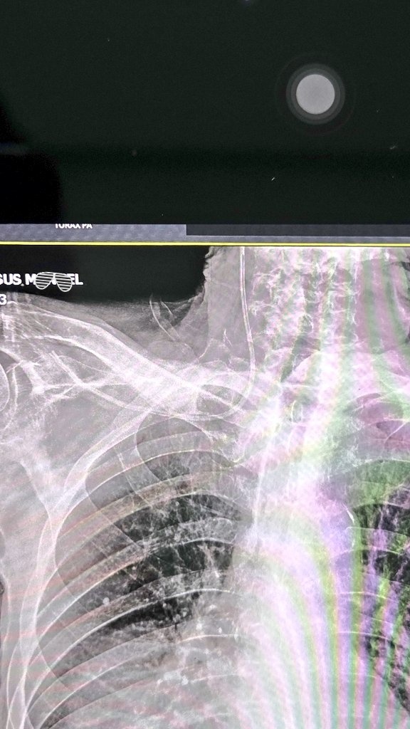 gluconaco de putasio tweet media