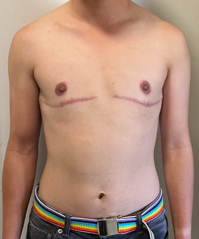 <a href="/eu_eeas/">European External Action Service - EEAS 🇪🇺</a> <a href="/kajakallas/">Kaja Kallas</a> As an African, I see you as trash. No principles. No morality. Just disgusting scum giving lessons to the rest of the world. Genital mutilation is covered by public health insurance in Europe!