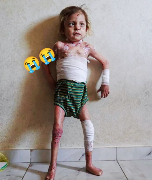 Yousef in Gaza 🇵🇸 tweet media