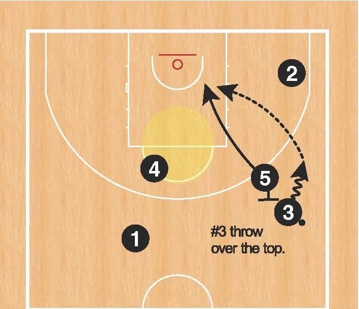 Here is a set that removes the backside help and creates a great chance to throw over the top, isolating the post at the rim.