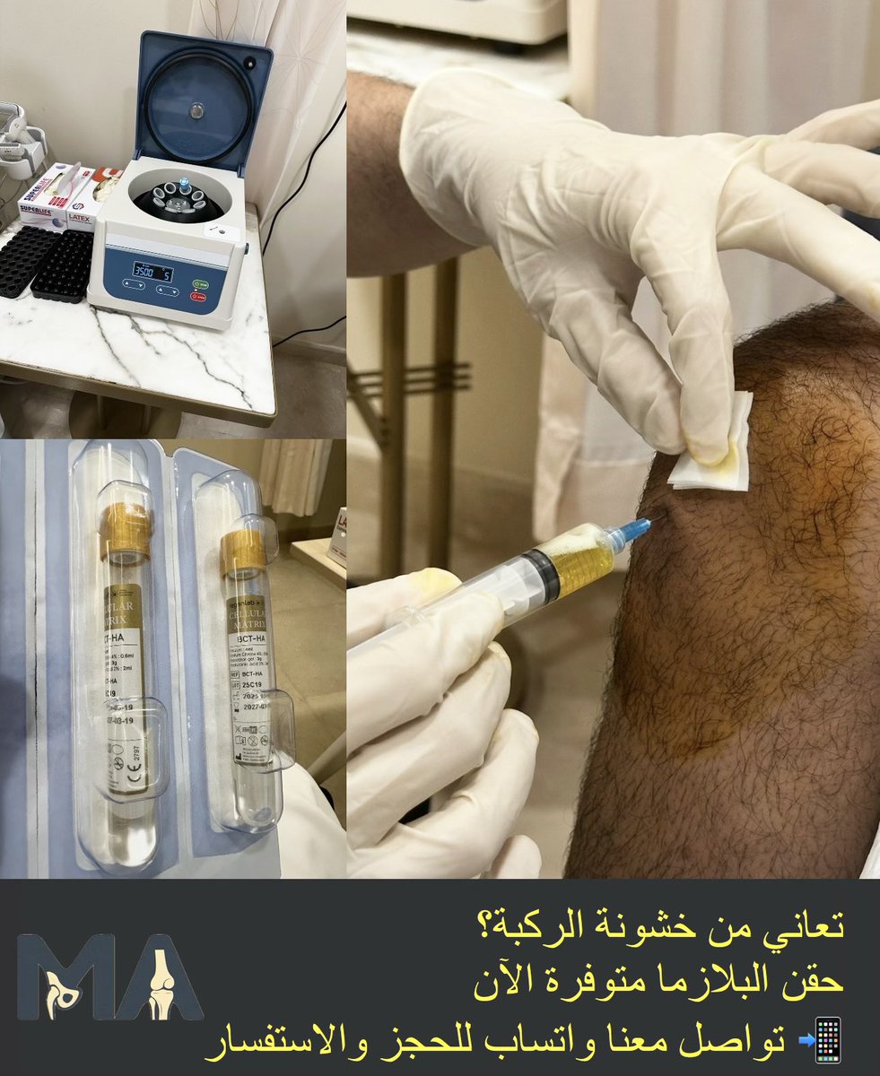 mabushal's tweet photo. #خشونة_الركبة
#إبر_البلازما https://t.co/iTNIOa8yxz