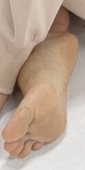 X18Mw's tweet photo. 足でかくて角質あるの最高
#足裏 #足フェチ #feet https://t.co/4ZeB6vfojB