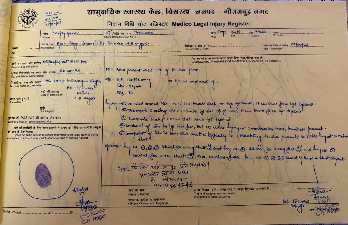 sandeep6351's tweet photo. माननीय @SHObisrakh @NoidaPolice,
संलग्न शिकायत में एक परिवार पर हुए हमले, मारपीट व धमकी का उल्लेख है। महिलाओं व बच्चों से भी हिंसा हुई है। कृपया मामले की निष्पक्ष जाँच कर दोषियों पर कड़ी कानूनी कार्रवाई की जाए।
कृपया शीघ्र संज्ञान लें। 🙏
#UPPolice #NoidaPolice #Justice https://t.co/568093jaZK