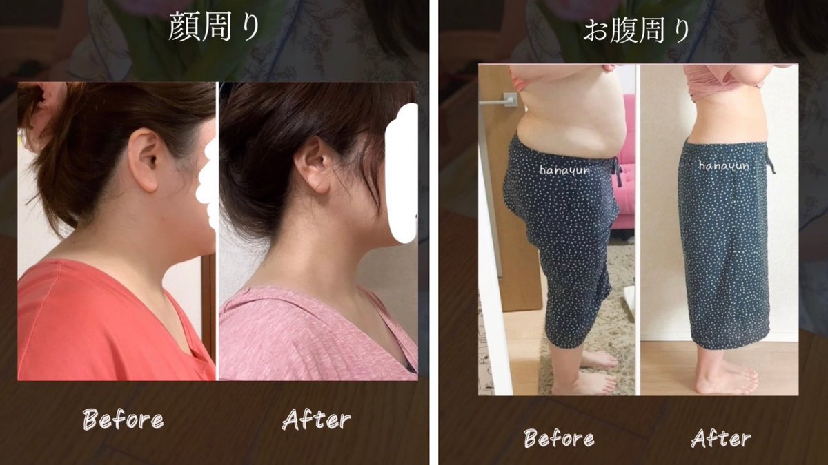 はなゆん@94kgからの大幅減量 (@hanayun_16294) / Posts / X