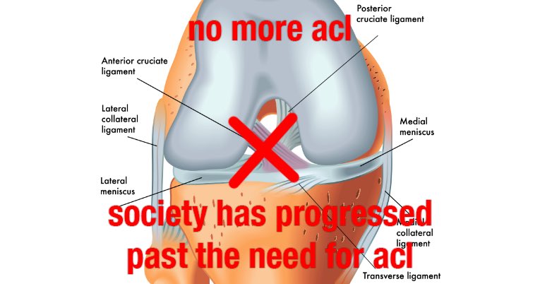 for too long we’ve let big orthopedics tell us we “need” these silly “ligaments” for “stability.” no more!