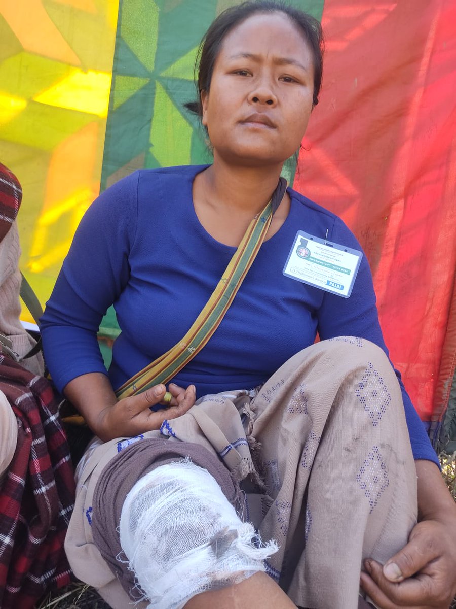 Commandant58Bn's tweet photo. On 07/02/25, a lady named Tengmoi (33 Yrs) w/o Nekyoy (9362902573) of Kangvai was brought to the 58 Bn Unit Hospital by her Husband with a Knee Injury, while working in the field for first aid.  Hospital staff provided first aid to her. They expressed their sincere gratitude. https://t.co/GejyhoISTw