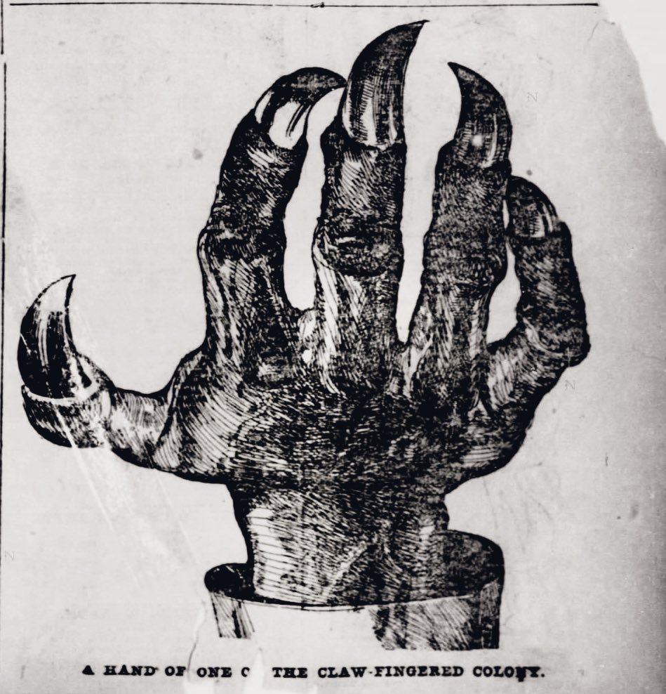 oddoldnews's tweet photo. Claw-Finger Folk 

St. Louis Post-Dispatch, St. Louis, Missouri · Sunday, August 30, 1896 https://t.co/GUBhRWefLP