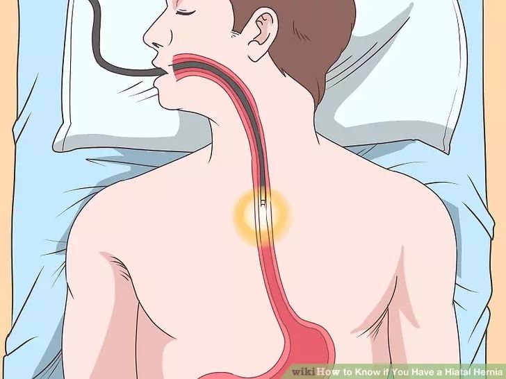 leakfixmaster's tweet photo. Precision Treatment for Lasting Relief
Choosing laparoscopic hiatal hernia repair means selecting a modern surgical approach that focuses on accuracy, safety, and patient comfort. This minimally invasive method uses small incisions.https://t.co/XBcdbLOz8N https://t.co/KV9DXSysKb