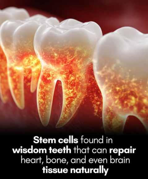Your wisdom teeth could save your life.

They contain stem cells that could repair your heart, bone, and even brain tissue.

What was once considered medical waste may soon be a powerful tool in regenerative medicine. 

Scientists have discovered that wisdom teeth — often removed