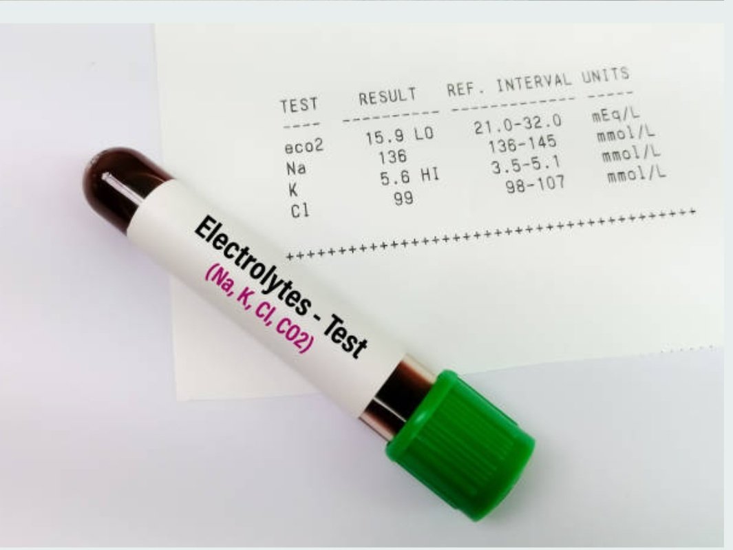 Quality_bio's tweet image. #معلومة_سريعة
الفرق بين Indirect ISE و Direct ISE
⤵️ القياس غير المباشر
❶ يتأثر بزيادة الدهون في العينة (Lipemia)
❷ يتأثر بارتفاع البروتينات (Hyperproteinemia)
⤵️ القياس المباشر 
❶ يُستخدم في أجهزة غازات الدم (ABG analyzers)
❷ لا يتأثر بالدهون أو البروتينات
#مختبرات_طبية