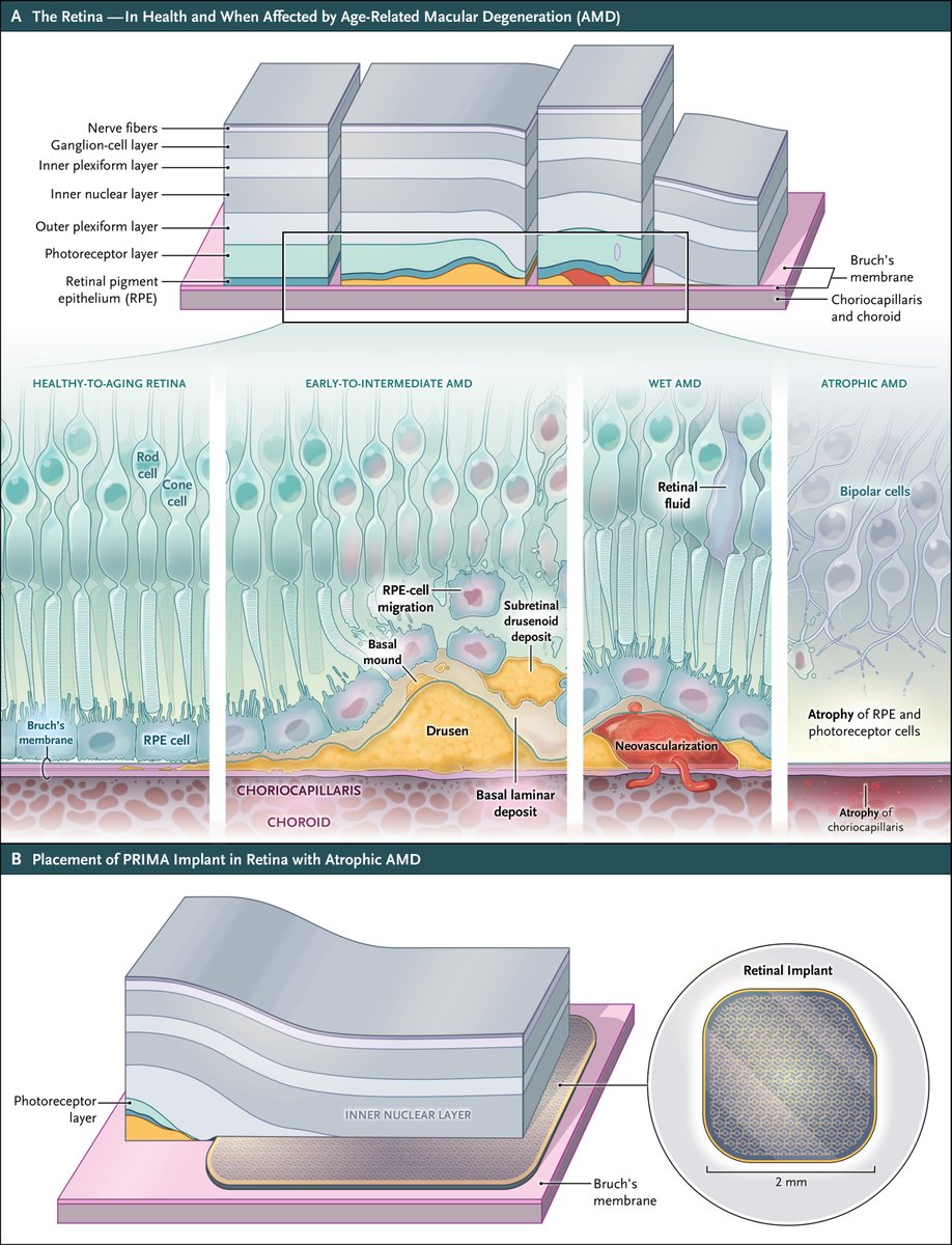 Igor Morr tweet media