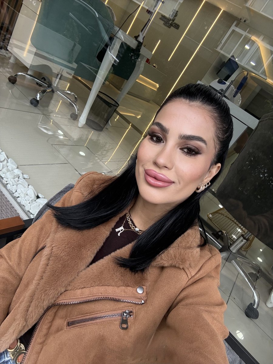 Neyse yine çok güzel olmuşum sinirlenmicem alsjxjsjsjx