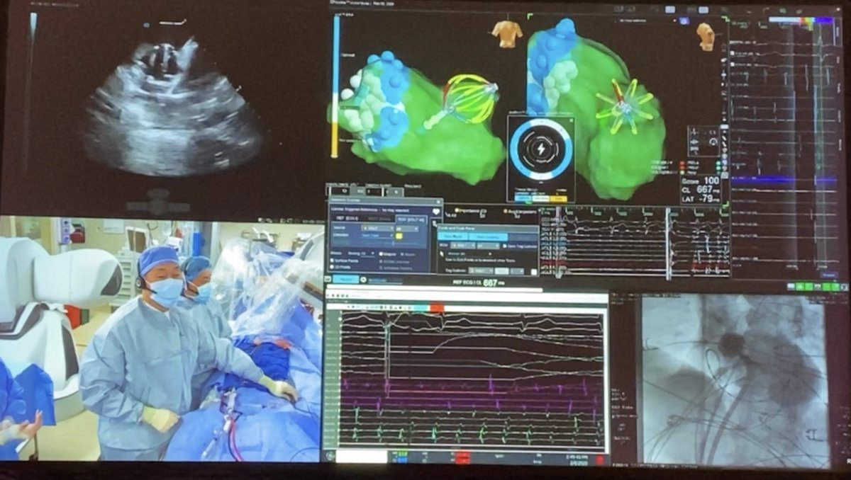 JoeProvost7's tweet photo. Outstanding live-case demo of #VoltPFA, showcasing balloon‑in‑basket tech, LivePoint Display, sedation flexibility & selectable electrodes.
Thanks to @DrRoderickTung, Dr. Wilber Su & the @BannerHealth team!
#AbbottProud #RevoltAgainstTheOrdinary
Safety: https://t.co/AraARu0qzr https://t.co/LKWNTbb6sL