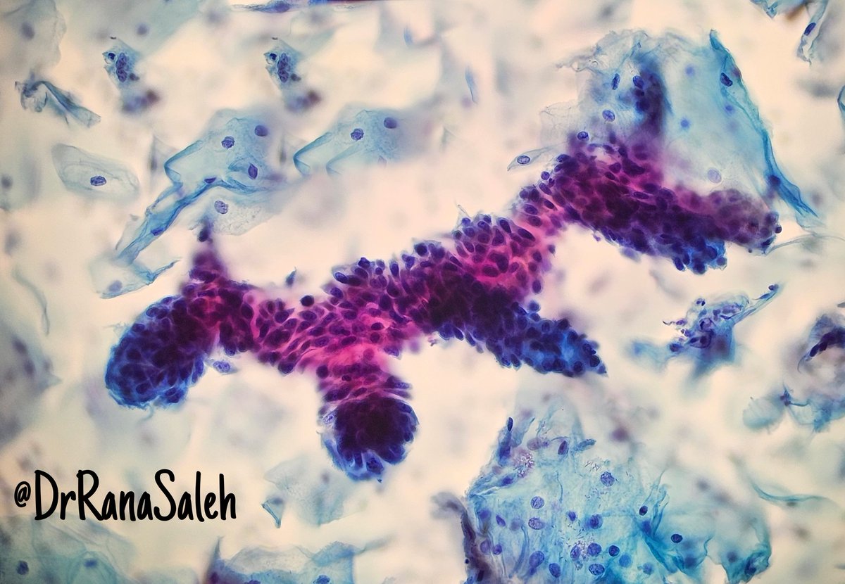 Rana Saleh, MD, FRCpath tweet media