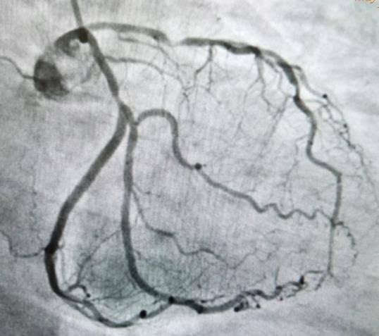 Somalaram Venkatesh tweet media