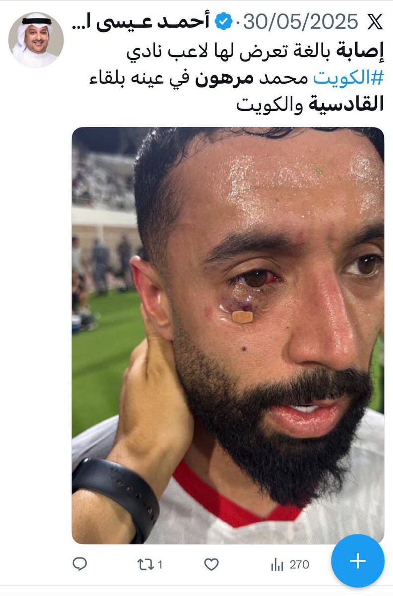 sport_mannnkw's tweet photo. بوقتها ولا واوي تكلم والحين زلغ برجل مهدي قوموا الدنيا قايلكم طقاقات محد صدقني😎 https://t.co/6O46jWTJlo