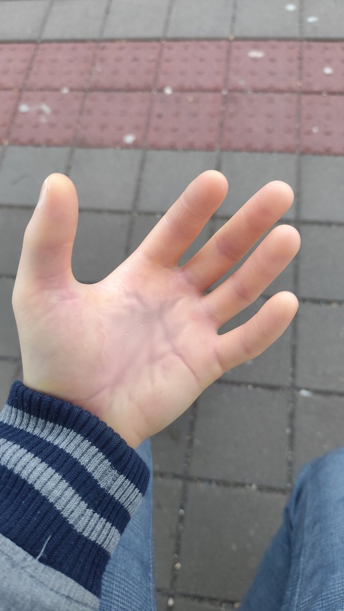 stealthgimp's tweet photo. Got inspired and went off to downtown with ultra thin transparent rubber gloves #rubbergloves #rubberhands https://t.co/yb1CjxW7JD