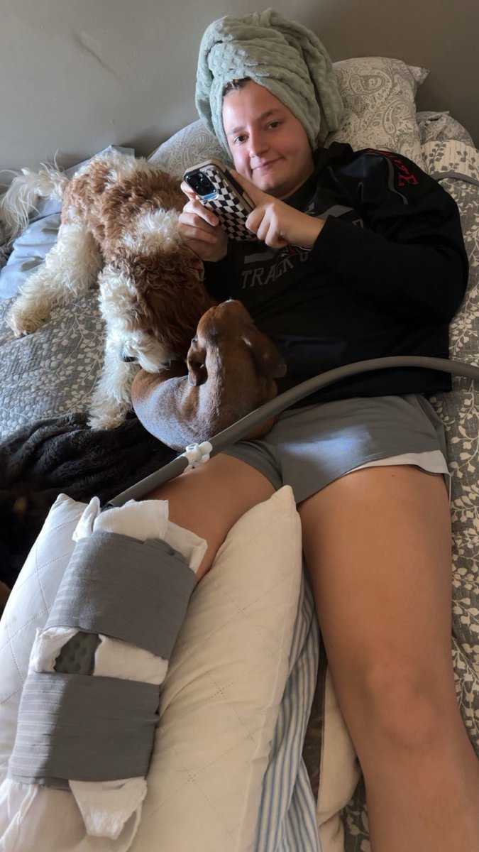 Finally got in for ACL surgery on Thursday and now am resting at home. Excited to start my road to recovery!!
