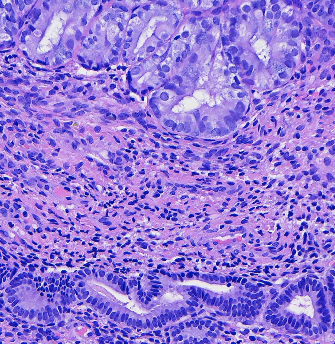 Toby Schmitt, MD tweet media