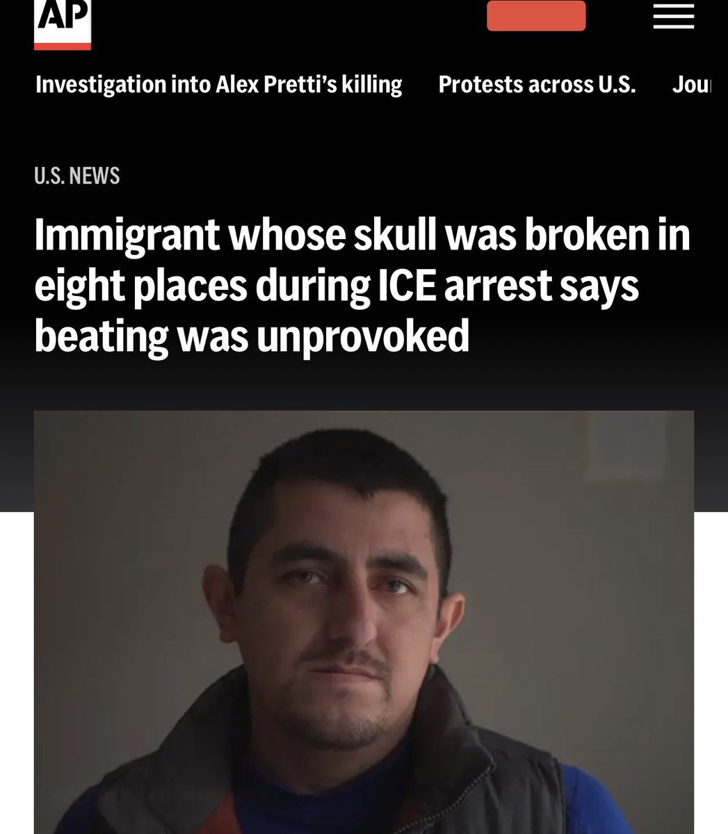 “They started beating me right away when they arrested me”

apnews.com/article/immigr…