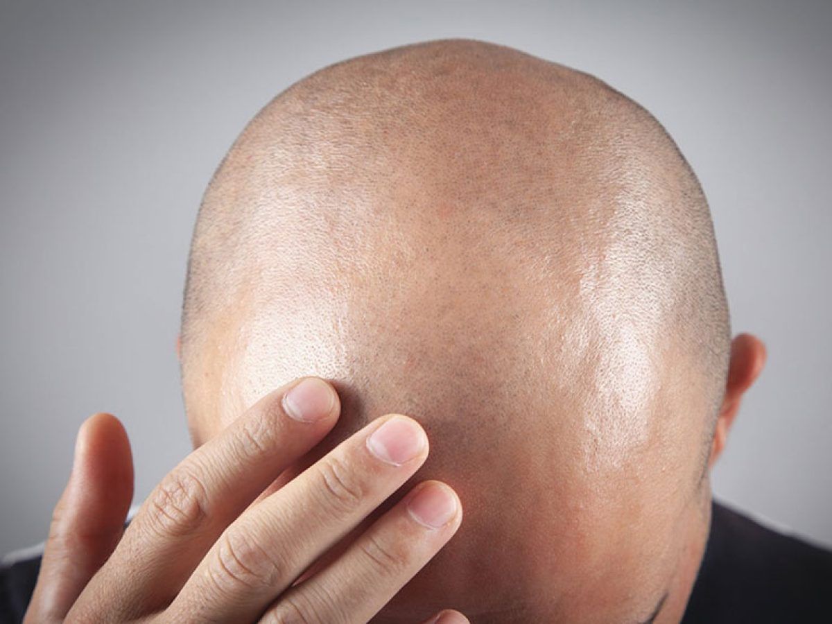 🔴 Türk bir firmanın saç bakım ürünü Tayvan’da 1.500+ kişi üzerinde test edildi. 

▪Klinik verilerde %90’ın üzerinde olumlu sonuç alınırken saçsız bölgelerde saç çıkışı ve %130–%500 saç yoğunluğu artışı gözlemlendi.

(DHA)