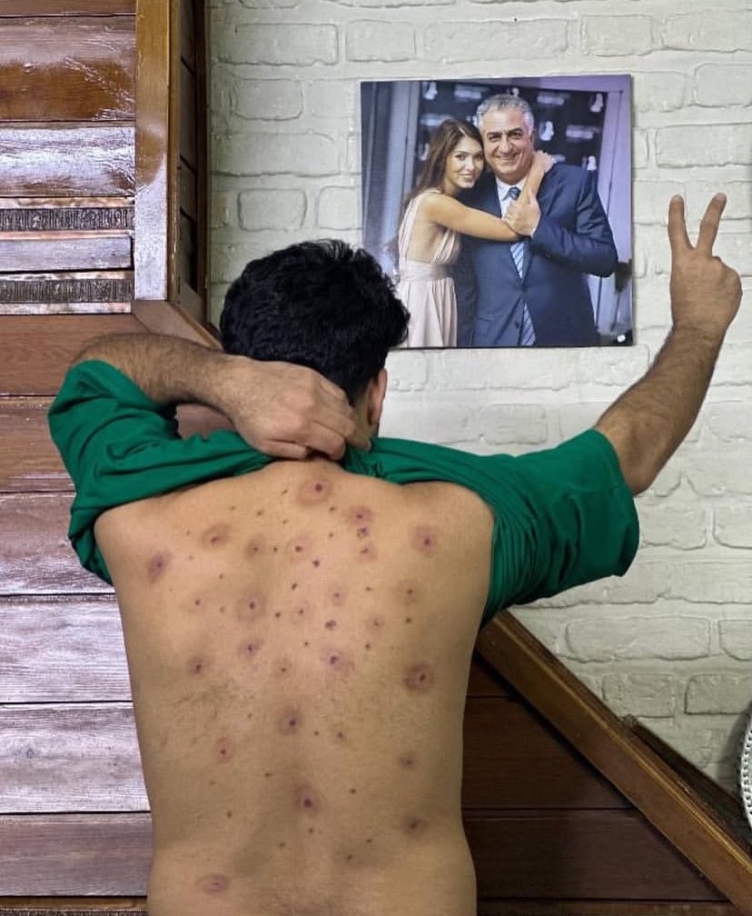 Ario1401's tweet image. ما زنده‌ ایم برای یک انتقام باشکوه 
#اين_آخرين_نبرده_پهلوى_برميگرده 
#جاويدشاه‌