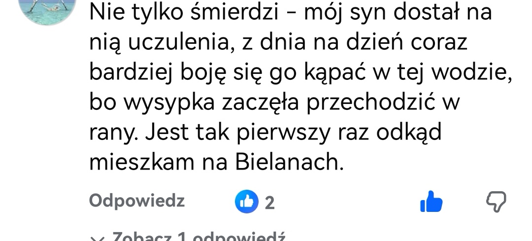 QueenFoxV's tweet photo. @trzaskowski_ Panie Prezydencie Co się dzieje z wodą w Warszawie? Śmierdzi intensywnie, zapach przypomina Domestos Mieszkańcy zgłaszają problem, a @RzecznikMPWiK  nie podają konkretnej przyczyny ani wyjaśnień. Prosimy o jasną i oficjalną informację🥺 https://t.co/hLzWiJsPtV