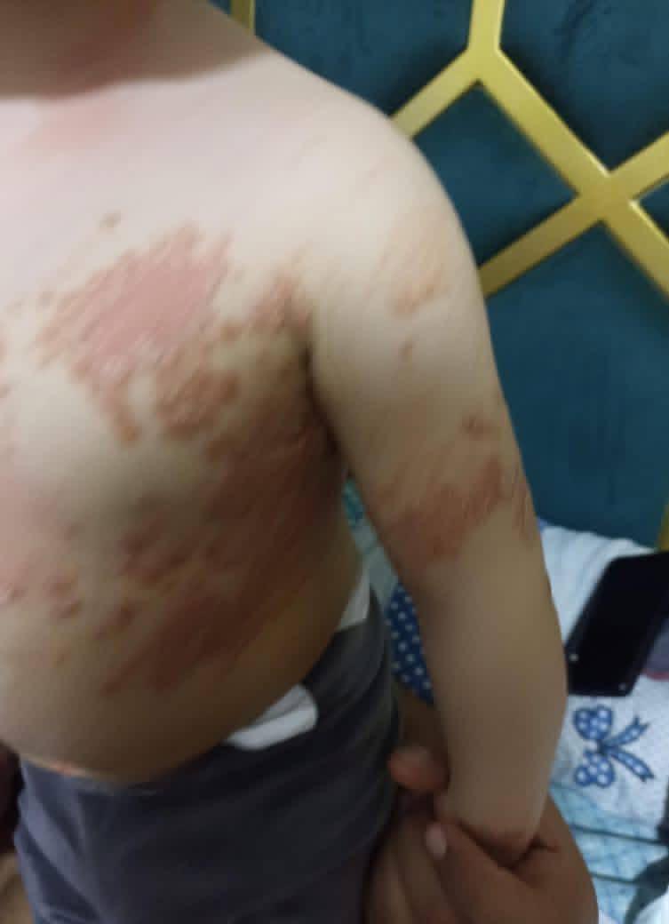 Dr_SaebGaza's tweet image. MY CHILD Will DIE😭

Unfortunately, my child, Maha , has been classified as malnourished, suffering from severe weakness and loss of appetite. I appeal to you to help provide food and vitamins

If you’re scrolling, PLEASE leave a dot . it's just a dot. gofundme.com/f/saeb-and-his…