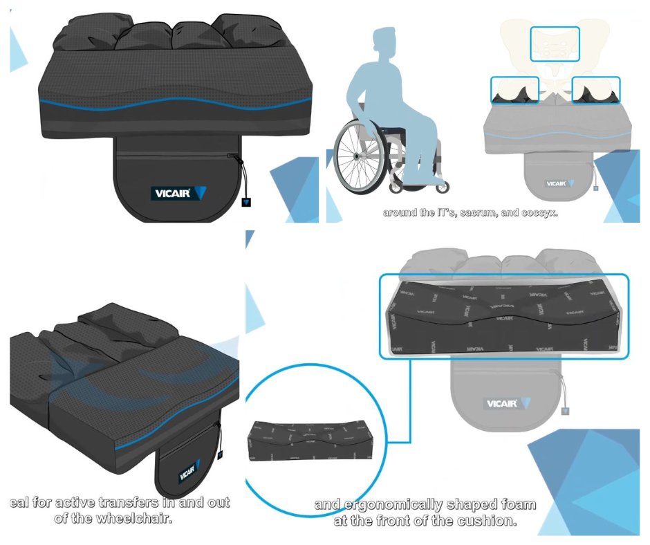 The Vicair Active O2 Cushion is pre-contoured &amp; lets you change the pressure via 4 separate compartments. This design protects high risk areas such as the ischial, coccyx &amp; makes transfers easier.

spinalpedia.com/community/vide…

#wheelchaircushion #pressurewound #spinalcordinjury
