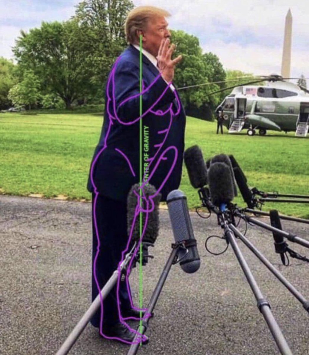 whoever’s out there making fun of the way i stand, just know this is the reason 😔