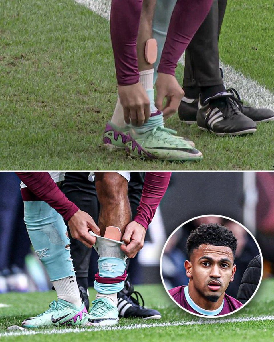 ActuFoot_'s tweet photo. Les plus petits protège-tibia que vous verrez aujourd’hui. 😁🦵

Marcus Edwards 🏴󠁧󠁢󠁥󠁮󠁧󠁿 les portait ce samedi avec Burnley.

📸 @ESPNUK https://t.co/MDpbh95AVh