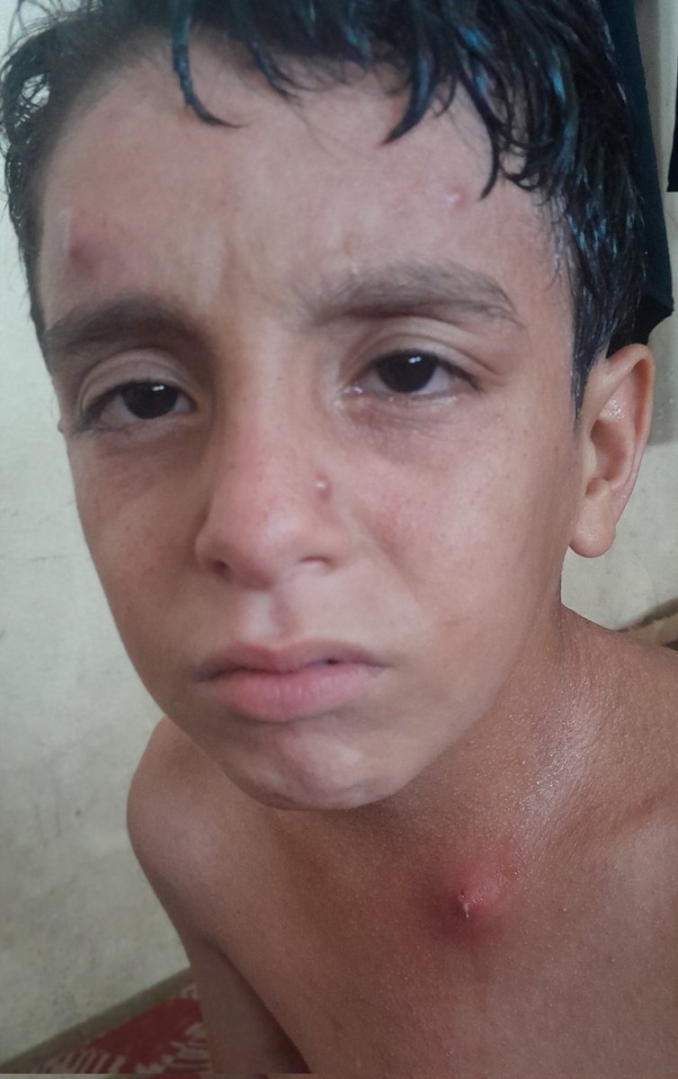 RozeatG's tweet photo. ๐Adam is suffering from a contagious rash due to the pollution dirt and dust in his environment His condition is worsening day by dayand I can't afford treatment or cleaning supplies Please help me so I can treat him๐
Even a dot would be appreciated
https://t.co/PoTNVpFQz3 https://t.co/GXrX2WhItu