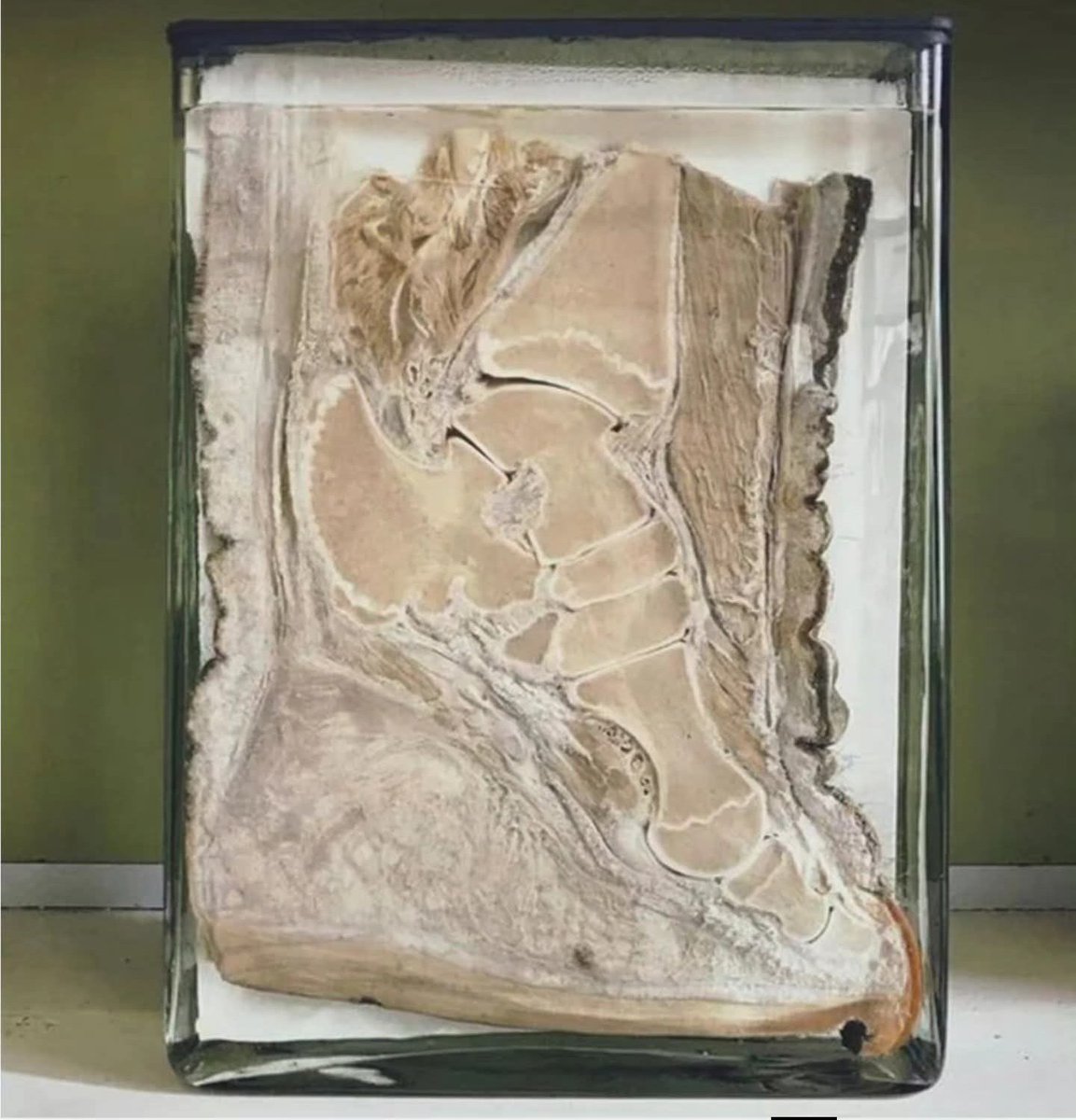 The internal structure of an elephant’s foot is remarkably similar to a human foot.... 

It contains 5 toes, as well as tarsal and metatarsal bones that form an arch. From the outside, the foot looks like a solid, pillar like column, but X rays reveal a human like skeletal