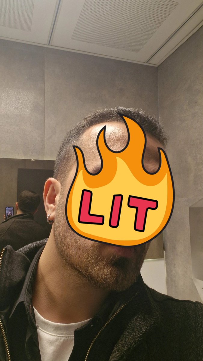 Kısa saç modeli 
Kelleşme belirtileri 
Enflasyon 
Mastürbasyon 
Konur fonu
Kapama telefonu