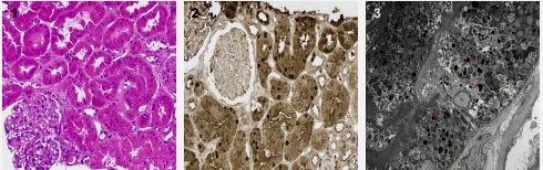 Sam Albadri, M.D., M.Sc. tweet media