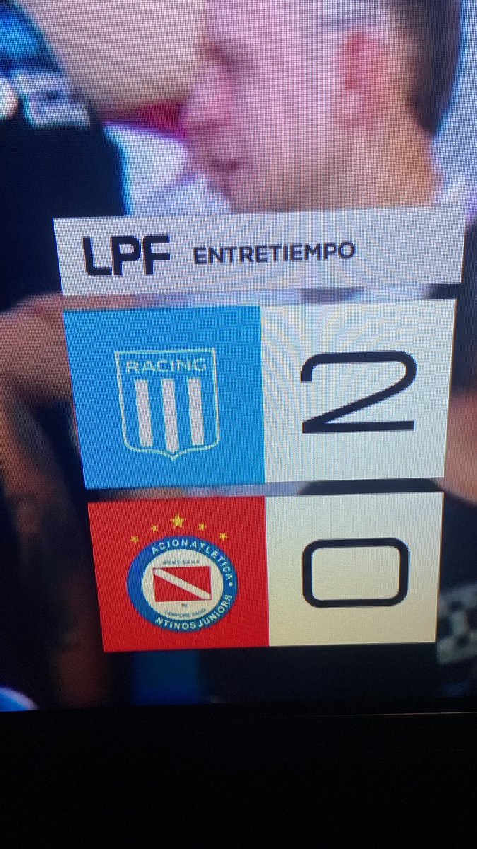 hermano que carajo, le falta una parte al escudo de Argentinos AAAJJJJJJ