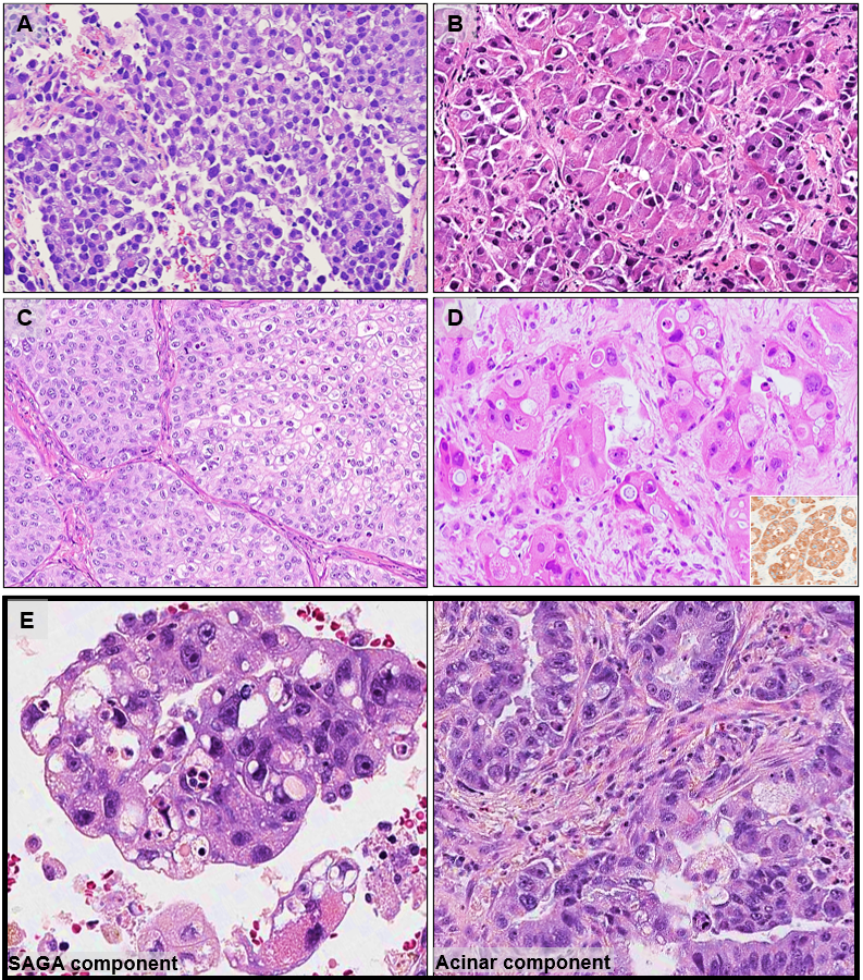 Natasha Rekhtman MD PhD tweet media