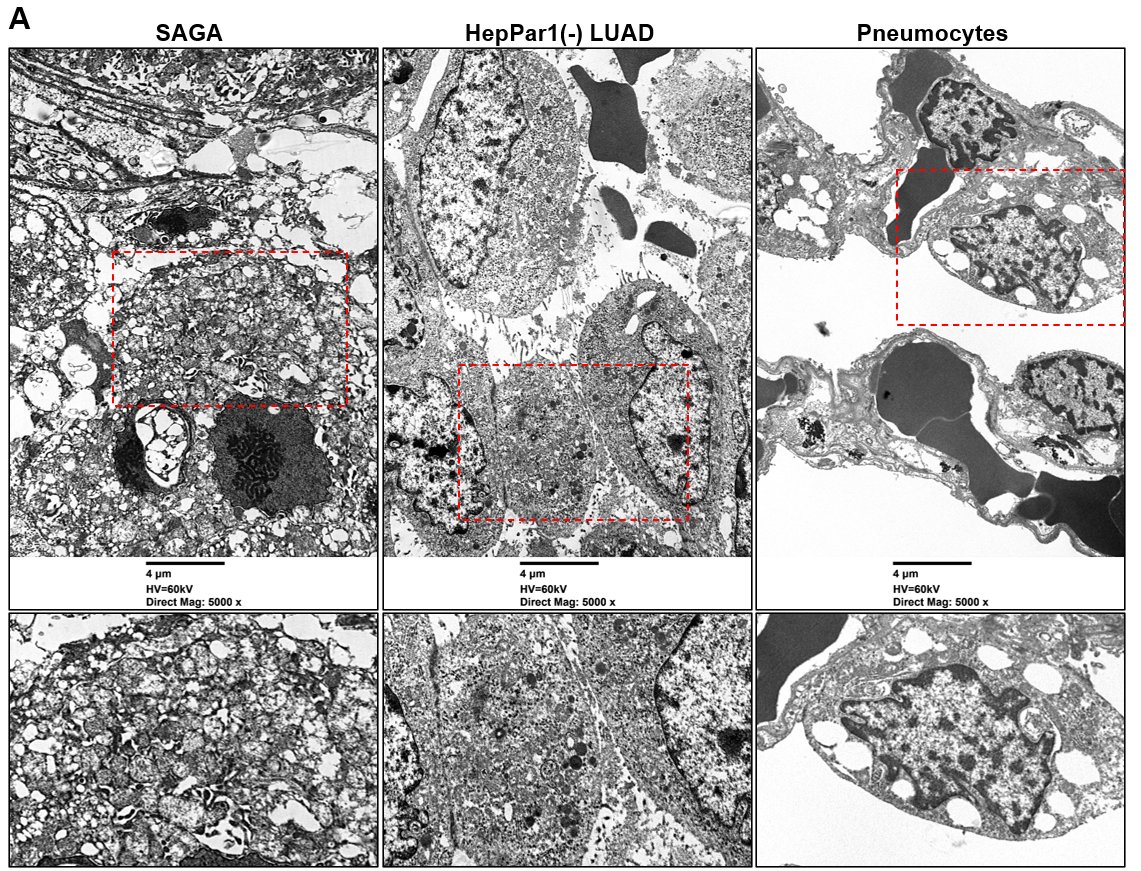 Natasha Rekhtman MD PhD tweet media