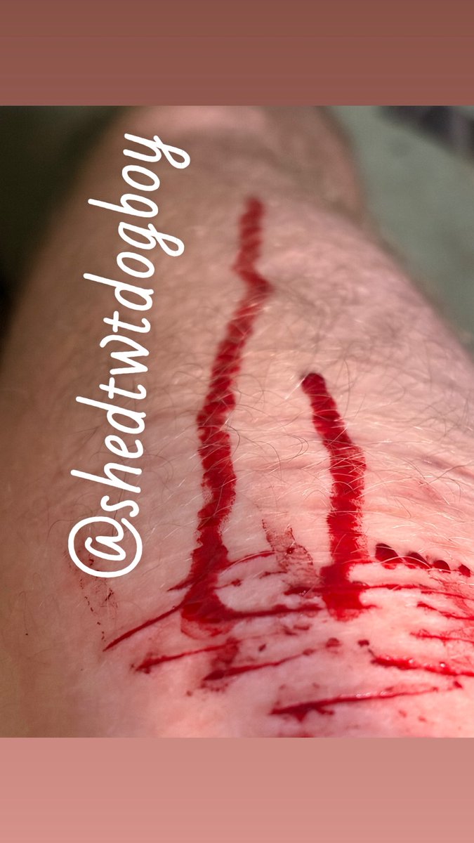 shedtwtdogboy's tweet photo. something abt that i was almost 4 months clean

#shedtwt #shtwt #988twt #raspberryfilling #raspberryfillingtwt #styro #catscratches 

my leg looks skinny in the first pic 🤩 https://t.co/gAoYeuT91s