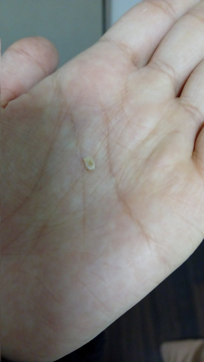 Aster's Japan survival diary - Day 123

Today...
I...

I have sligtly less teeth in my mouth...?