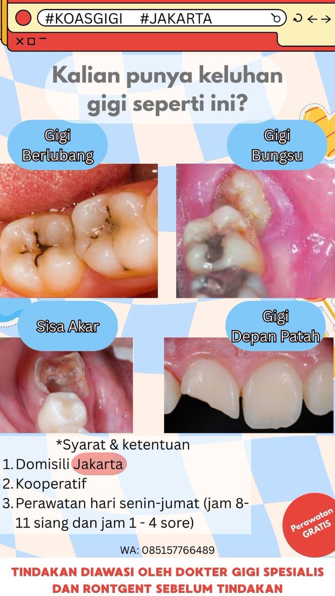 CoAxmtrapizeus's tweet photo. Yang ada masalah gigi anak ataupun dewasa boleh wa ya guys atau dm juga bisa https://t.co/J3UEEZf0ye