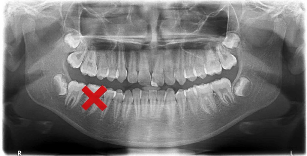 ส่วน ทีมห้องฟัน นั้น