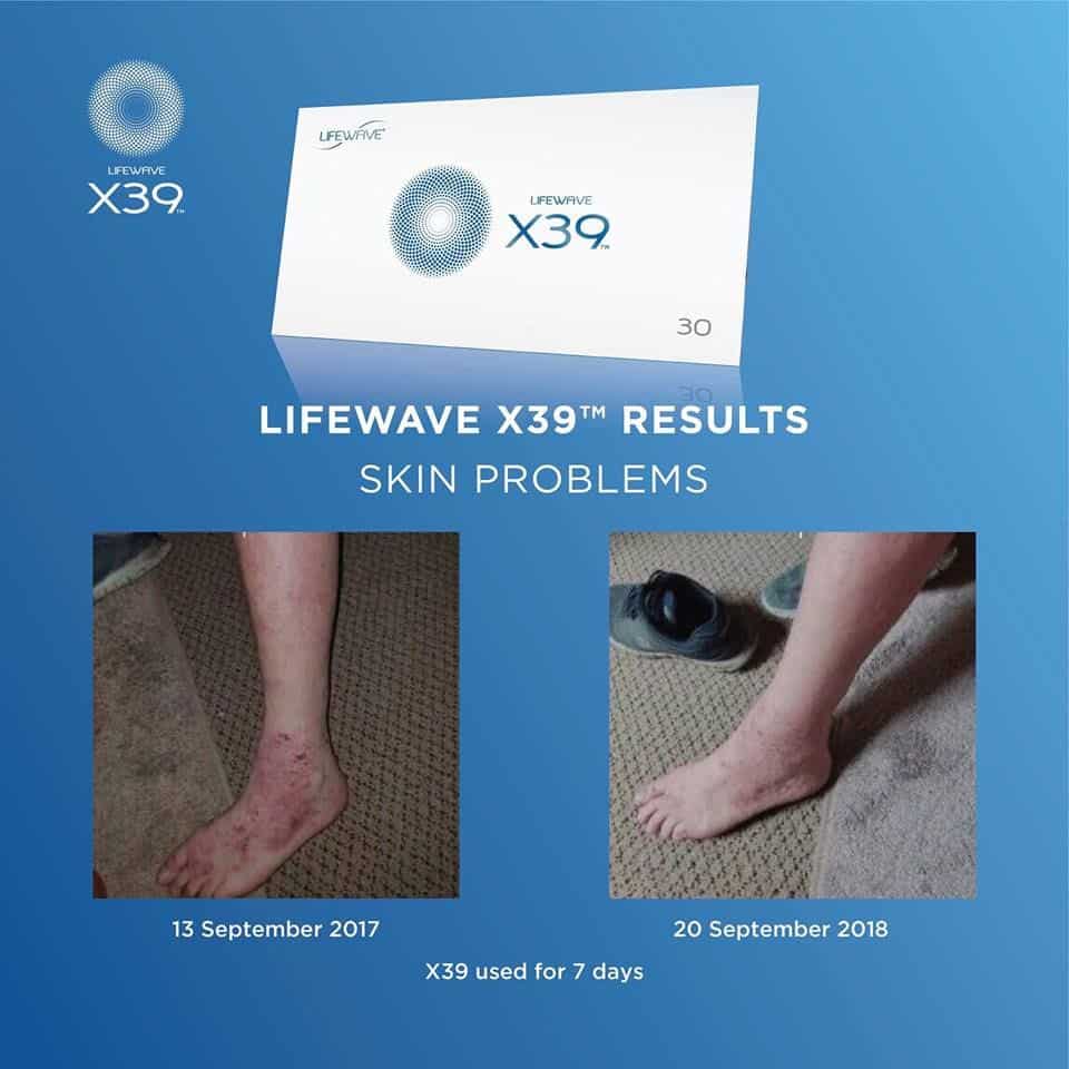 Geonua's tweet image. Delving into innovative energy flow methods with science-driven wellness tech is AMAZING! Even small tweaks lead to big results. I'm thrilled by our ability to support holistic wellness and stay active! #WellnessInnovation #StayActive