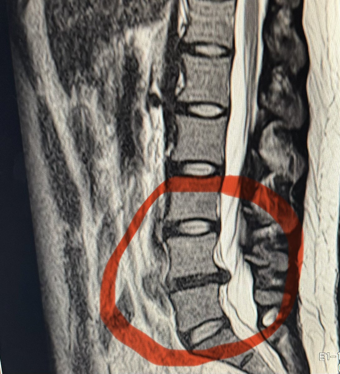 Soaking Umbrella tweet media