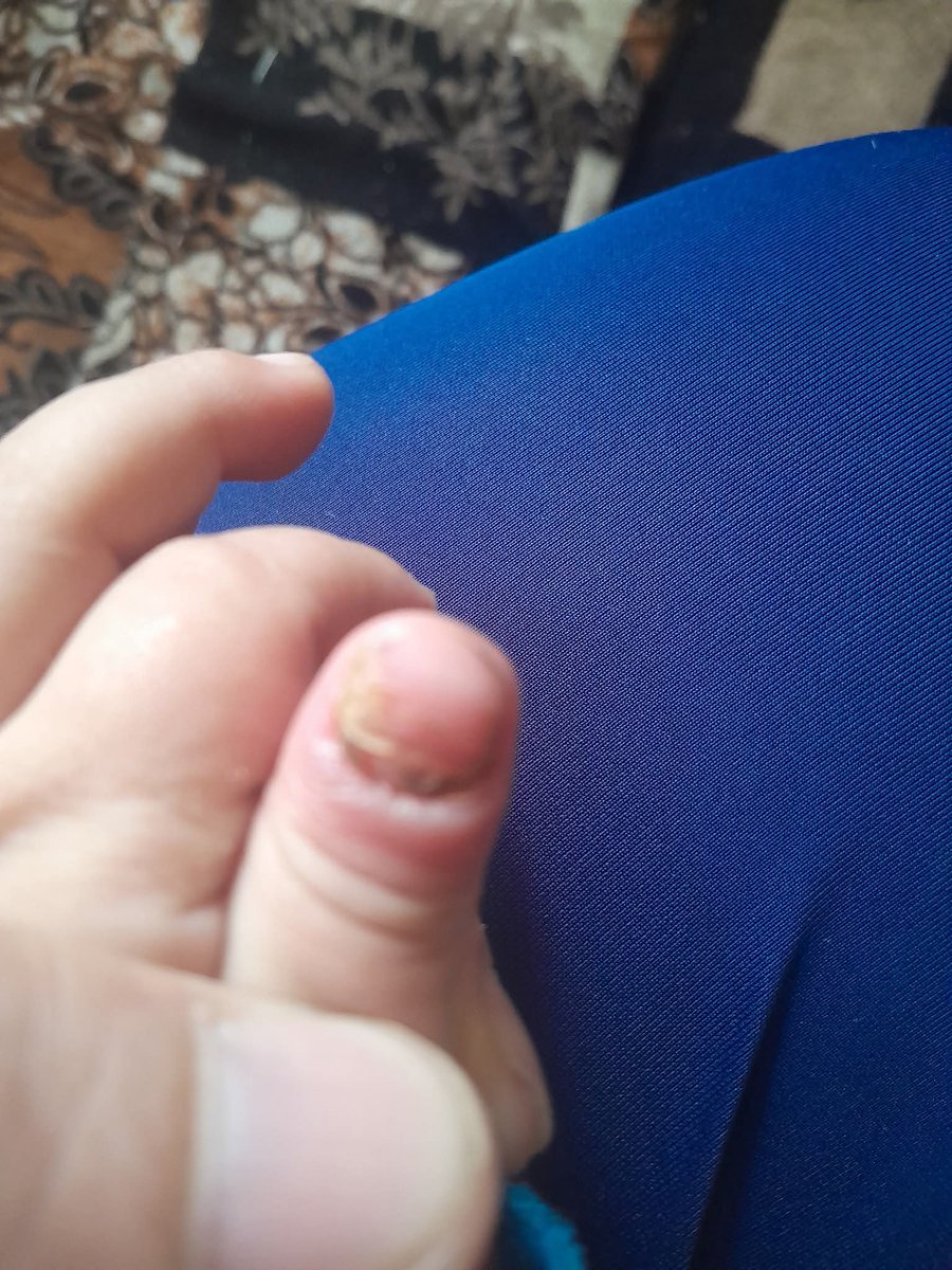 📢
🇵🇸
📢
🇵🇸
📢
🇵🇸
📢
🇵🇸
📢
🇵🇸
📢
🇵🇸
📢
🇵🇸
📢
🇵🇸
📢
🇵🇸
📢
🇵🇸
📢
🇵🇸
📢
🇵🇸
📢
🇵🇸
📢
🇵🇸
📢
🇵🇸
📢
🇵🇸
📢
🇵🇸
📢
🇵🇸
📢
🇵🇸
📢
🇵🇸
📢
🇵🇸
📢
🇵🇸
📢
🇵🇸
📢
🇵🇸
📢
🇵🇸
📢
🇵🇸
📢
🇵🇸
📢
🇵🇸
📢
🇵🇸
📢
🇵🇸
📢
🇵🇸
📢
🇵🇸
📢
🇵🇸
📢
🇵🇸
📢
🇵🇸
📢
🇵🇸
📢
🇵🇸
📢
🇵🇸
📢
🇵🇸
📢
🇵🇸
📢
🇵🇸
📢
🇵🇸
📢

gofund.me/db91f3ce7