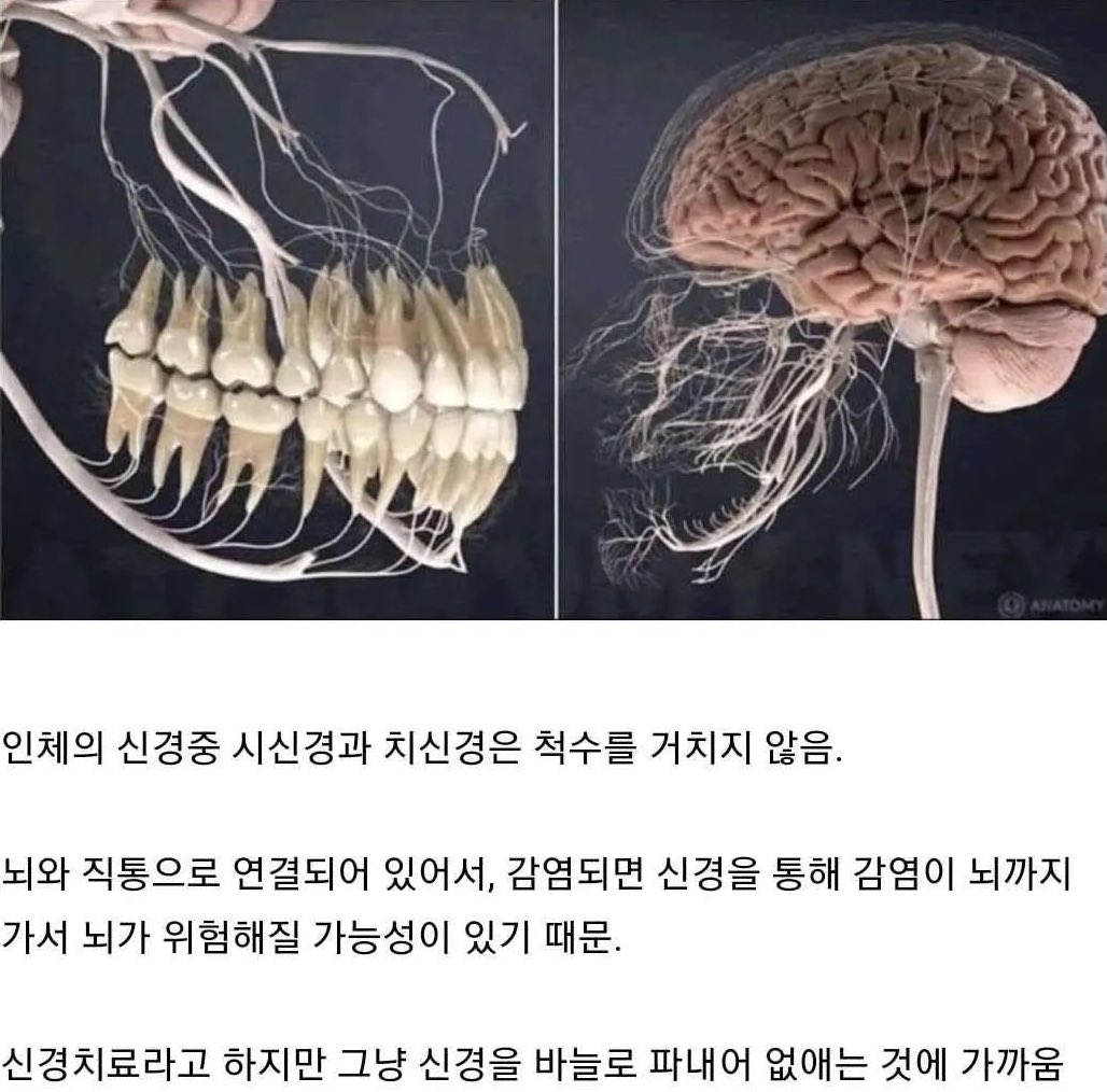 이렇게 보니 진짜 치아관리 중요하구나..
그리고 신경치료 너무 무섭다 🥶