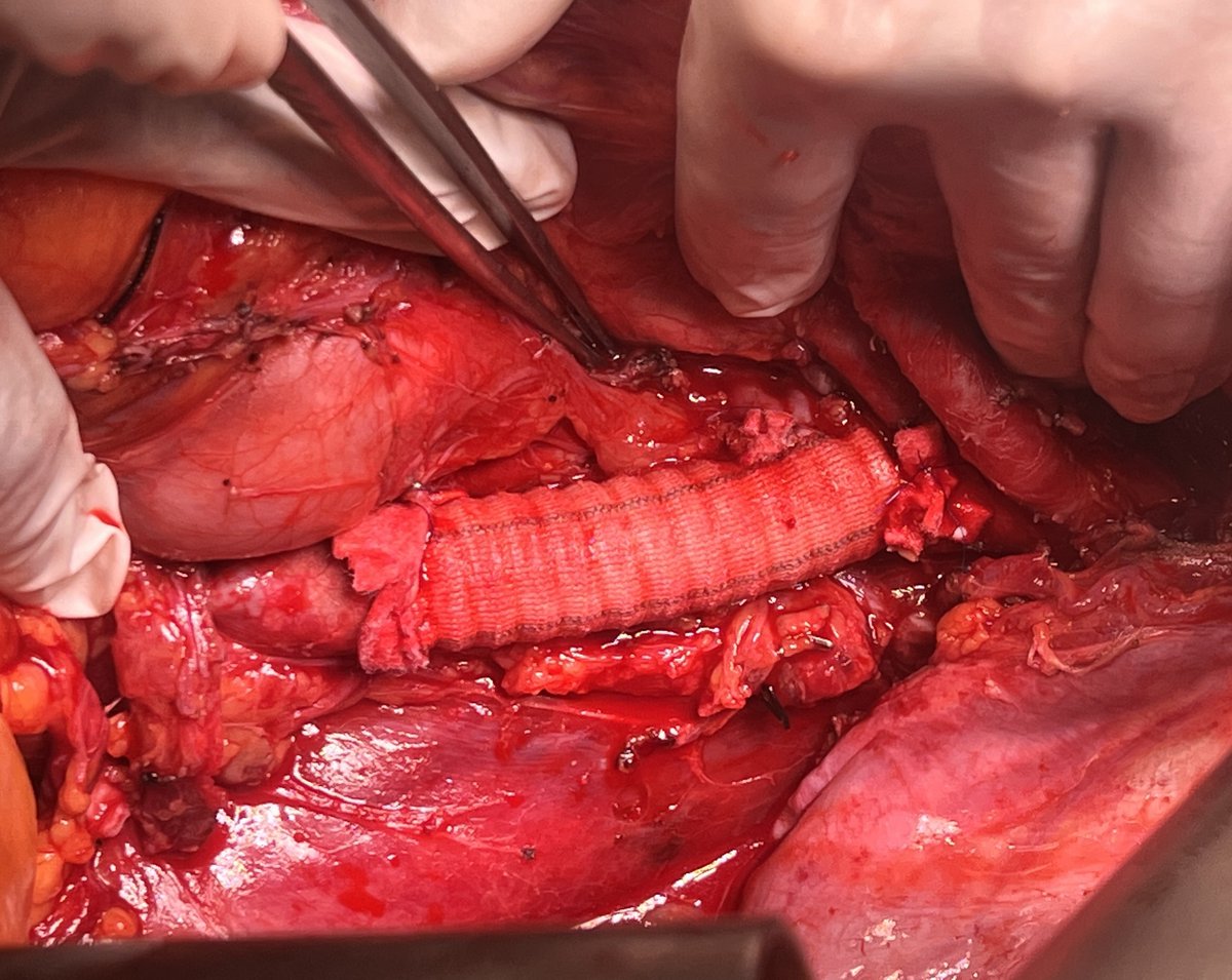 Dr Shivanesan Pitchai tweet media