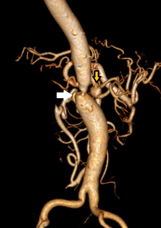 Dr Shivanesan Pitchai tweet media